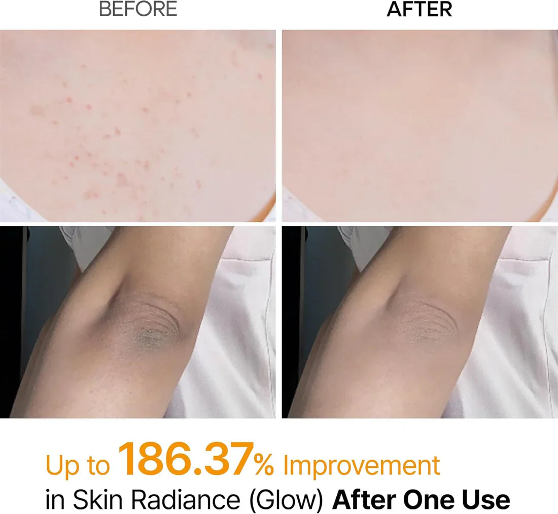 SkinVive Peel Shot